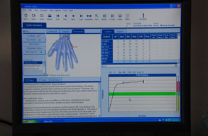 Biomeridian Hand Analysis
