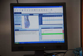 Biomeridian Foot Analysis