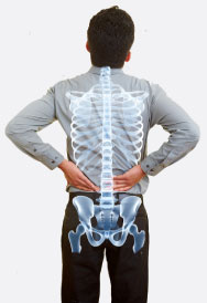 Back X-Ray